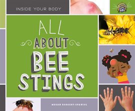 Cover image for All About Bee Stings