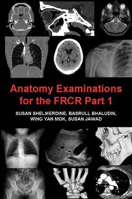 Imagen de portada para Anatomy Examinations for the FRCR Part 1