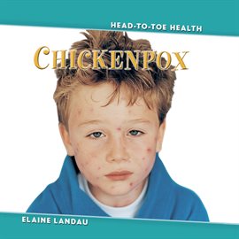 Cover image for Chickenpox