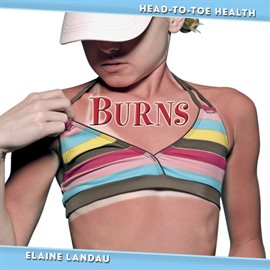 Cover image for Burns