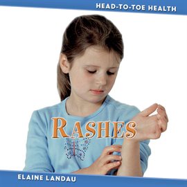 Cover image for Rashes