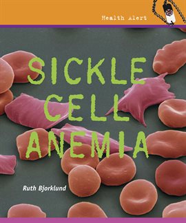 Imagen de portada para Sickle Cell Anemia