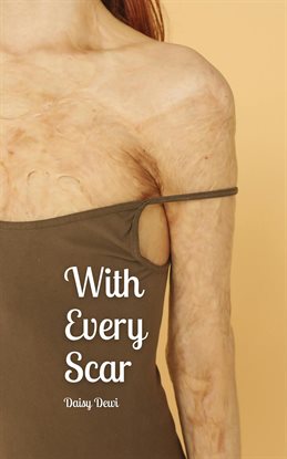 Cover image for With Every Scar