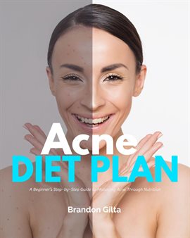 Cover image for Acne Diet Plan