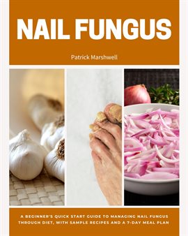Imagen de portada para Nail Fungus
