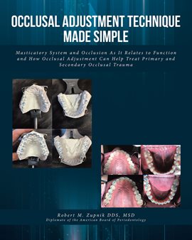 Cover image for Occlusal Adjustment Technique Made Simple