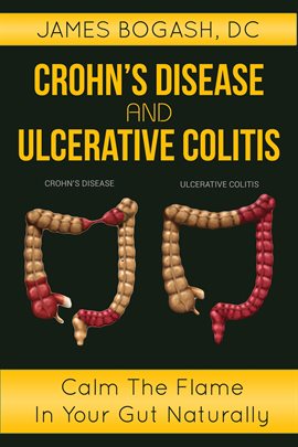 Cover image for Crohn's Disease and Ulcerative Colitis: Calm the Flame in Your Gut Naturally