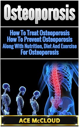 Cover image for Osteoporosis: How to Treat Osteoporosis: How to Prevent Osteoporosis: Along With Nutrition, Diet