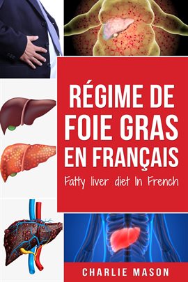 Cover image for Régime de foie gras En français