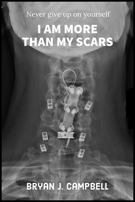 Cover image for I Am More Than My Scars: Never Give Up on Yourself