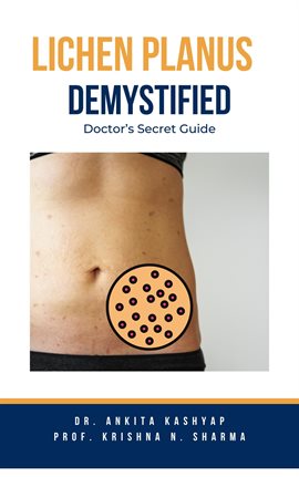 Cover image for Lichen Planus Demystified Doctors Secret Guide