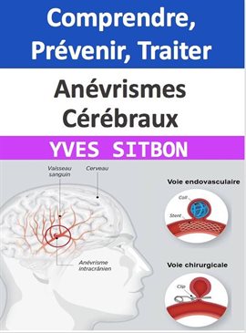 Cover image for Anévrismes Cérébraux: Comprendre, Prévenir, Traiter