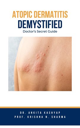 Imagen de portada para Atopic Dermatitis Demystified: Doctor's Secret Guide