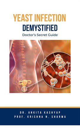Cover image for Yeast Infection: Demystified Doctor's Secret Guide