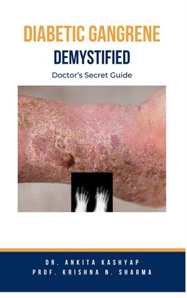 Cover image for Diabetic Gangrene Demystified: Doctor's Secret Guide
