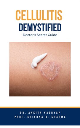 Cover image for Cellulitis Demystified: Doctor's Secret Guide