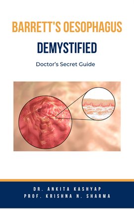 Cover image for Barretts Oesophagus Demystified: Doctor's Secret Guide