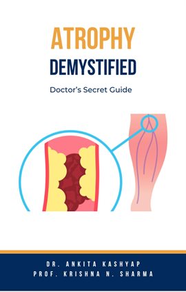 Cover image for Atrophy Demystified: Doctor's Secret Guide