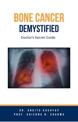 Cover image for Bone Cancer Demystified: Doctor's Secret Guide