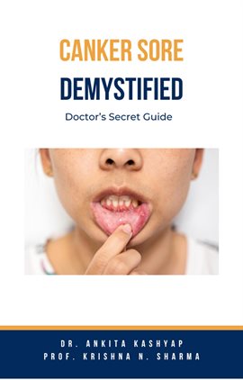 Cover image for Canker Sore Demystified: Doctor's Secret Guide