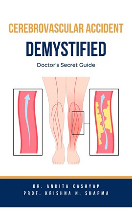 Cover image for Cerebrovascular Accident Demystified: Doctor's Secret Guide