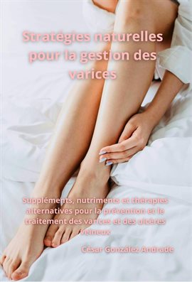 Cover image for Stratégies naturelles pour la gestion des varices