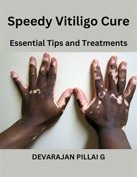 Imagen de portada para Speedy Vitiligo Cure: Essential Tips and Treatments