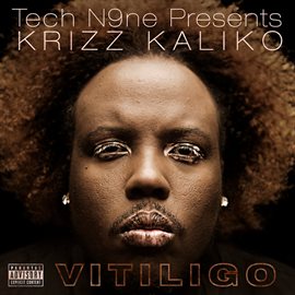 Cover image for Vitiligo