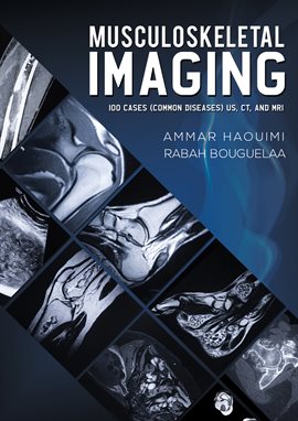 Cover image for Musculoskeletal Imaging