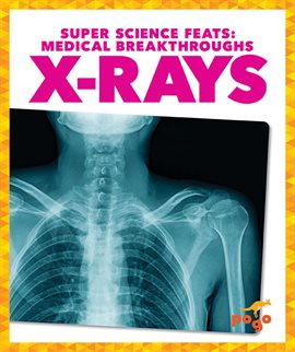 Cover image for X-Rays