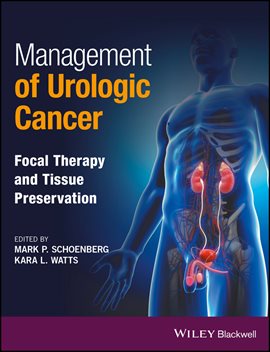 Cover image for Management of Urologic Cancer