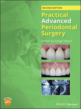 Cover image for Practical Advanced Periodontal Surgery