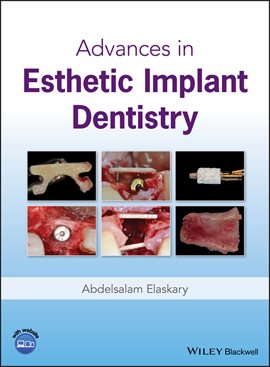 Imagen de portada para Advances in Esthetic Implant Dentistry