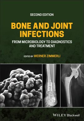 Cover image for Bone and Joint Infections