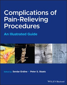 Imagen de portada para Complications of Pain-Relieving Procedures