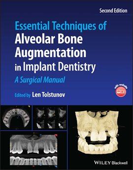 Imagen de portada para Essential Techniques of Alveolar Bone Augmentation in Implant Dentistry