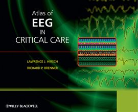 Imagen de portada para Atlas of EEG in Critical Care
