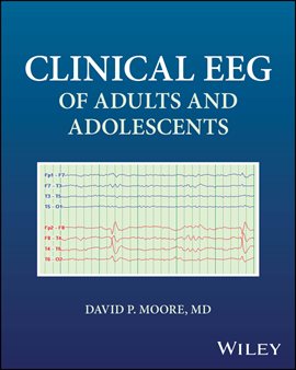 Clinical Eeg of Adults and Adolescents