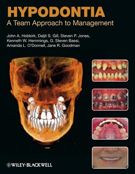 Cover image for Hypodontia