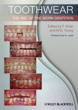 Imagen de portada para Toothwear