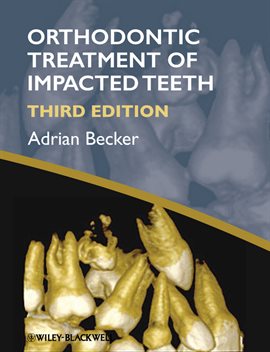 Cover image for Orthodontic Treatment of Impacted Teeth