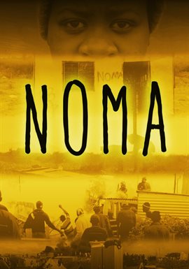 Noma