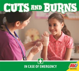 Imagen de portada para Cuts and Burns
