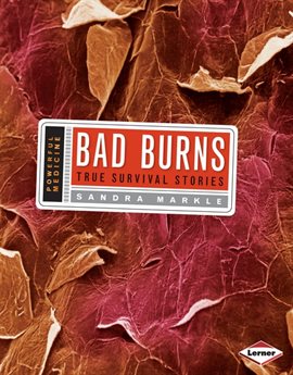 Cover image for Bad Burns