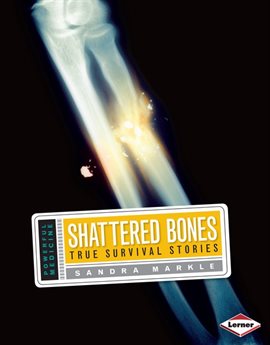 Cover image for Shattered Bones