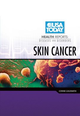 Cover image for Skin Cancer