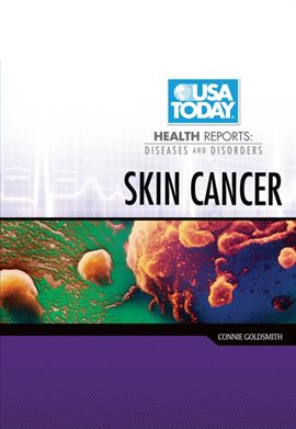 Imagen de portada para Skin Cancer
