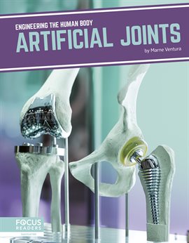 Cover image for Artificial Joints
