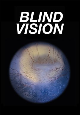 Blind Vision Blind Vision