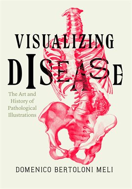 Cover image for Visualizing Disease